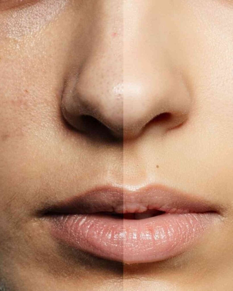 before and after anti-aging serum of face